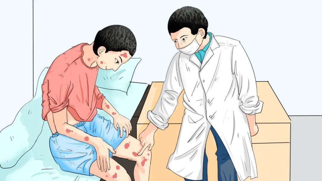 掌跖脓疱病是什么原因_掌跖脓疱病是什么引起的