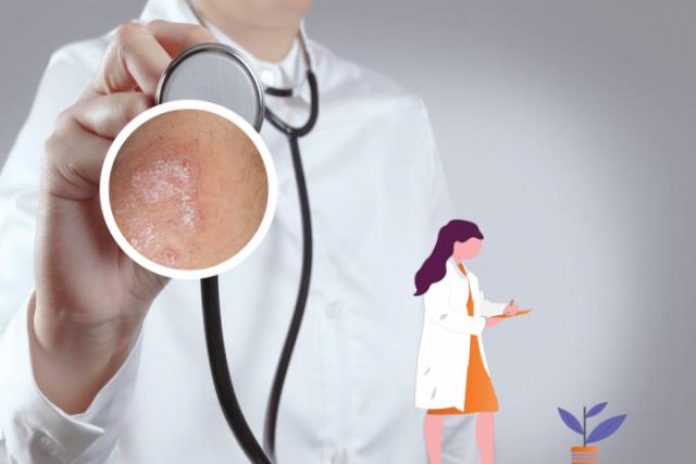 湿疹是什么原因造成的呢