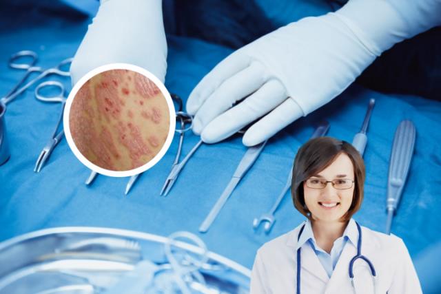 皮炎湿疹症状治疗方法