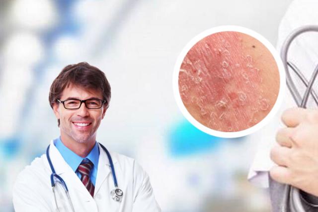 真菌感染皮肤病图片