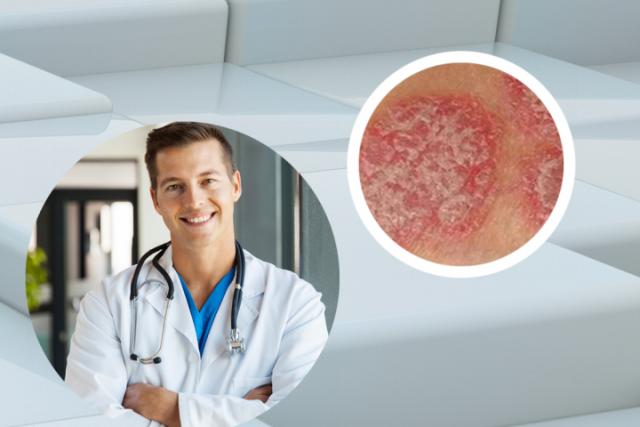什么叫皮肤癣菌瘤