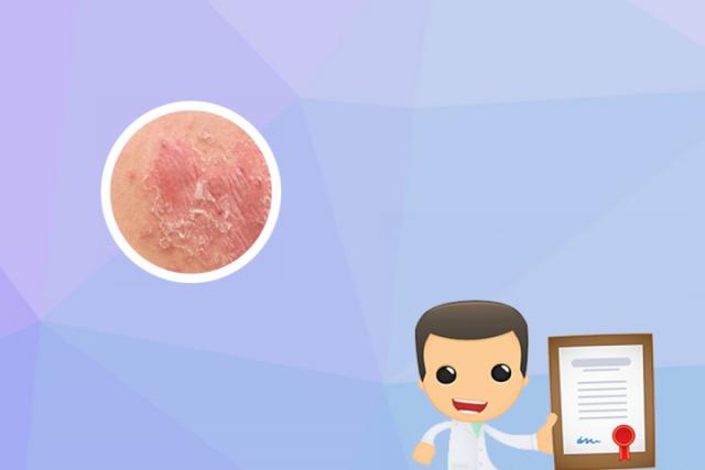 宝宝湿疹和热疹怎么区分图片