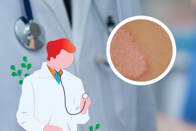 慢性湿疹怎么治疗能除根