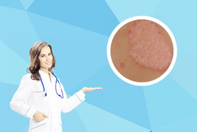 皮肤癣和湿疹是怎么引起的
