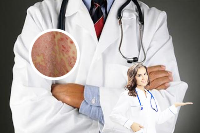 皮肤病血毒丸可以治疗哪些皮肤病
