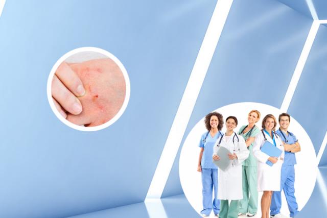 手上长湿疹是什么原因引起的怎么治疗
