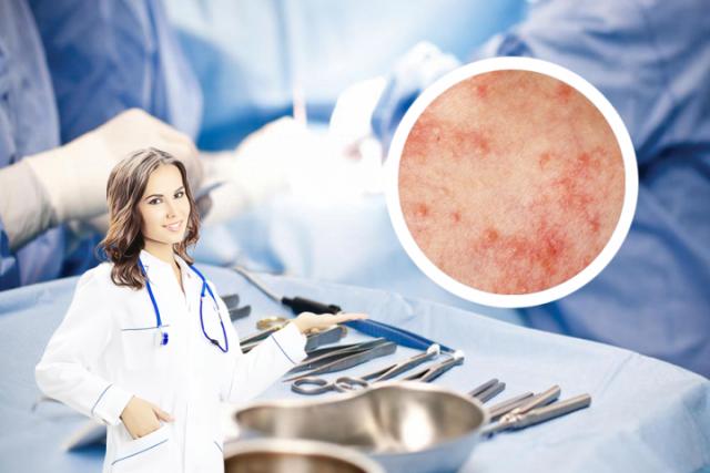湿疹是什么原因造成的
