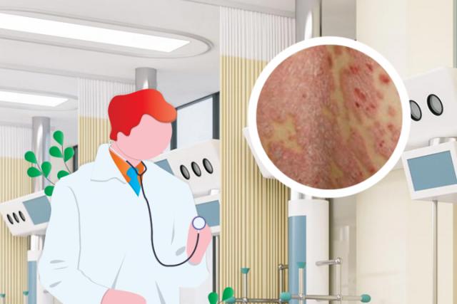 湿疹是什么原因造成的用什么药膏