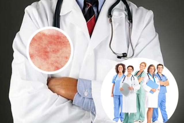 湿疹癣症状图片

