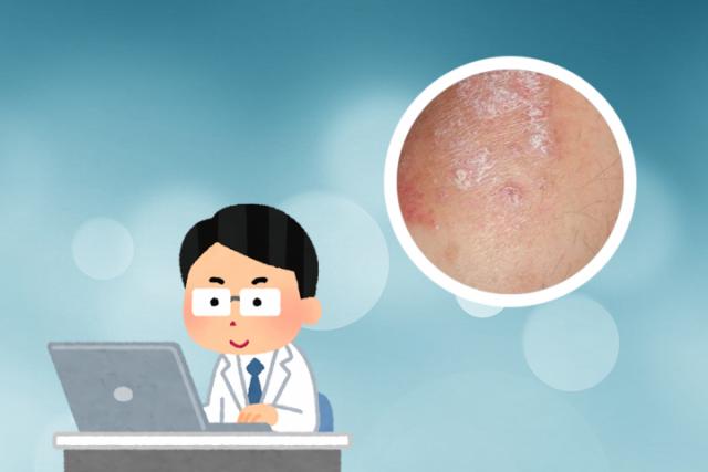 怎么区分湿疹和皮癣
