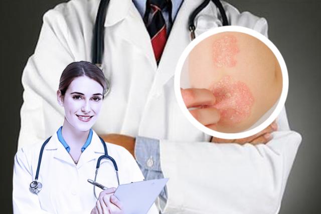 湿疹到底是什么样子什么症状