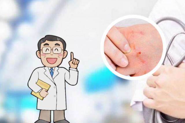 水疱型手癣与汗疱疹