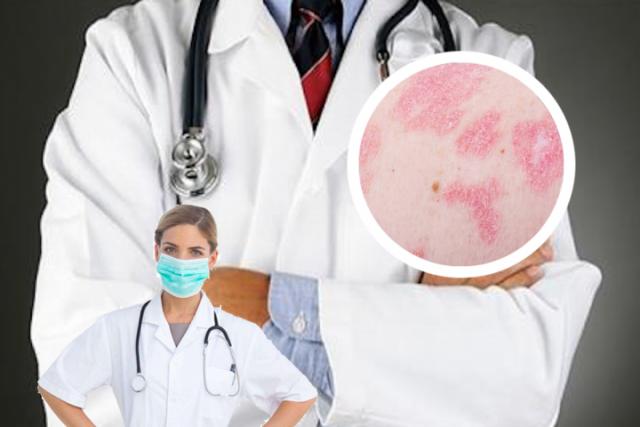 湿疹是怎么引起的呢