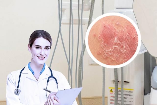 皮肤癣菌病图片
