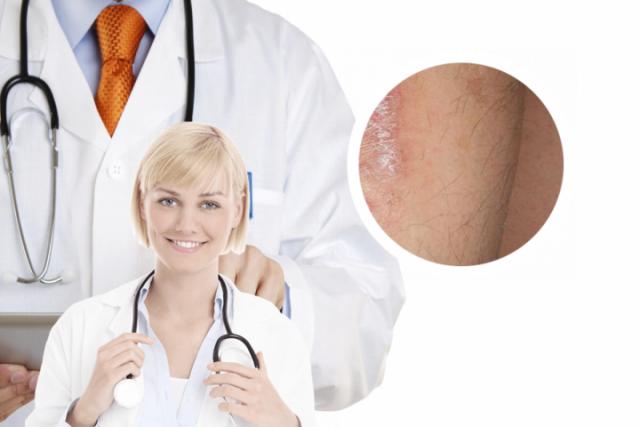 治疗皮肤癣病最有效的方法