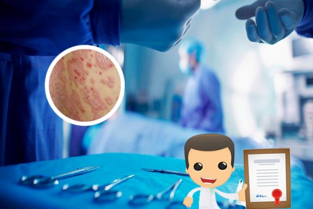 湿疹和皮癣应该用什么药
