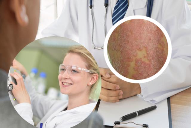 皮肤湿疹的症状与特征夏季