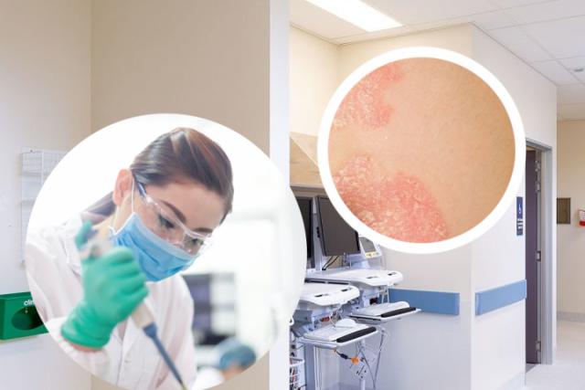湿疹样皮炎是什么原因引起的
