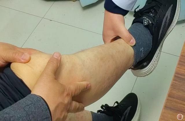 银屑病与膝关节置换